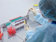 Forskning: Kreft-DNA kan oppdages i blodet flere år før diagnose