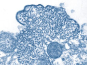 Nytt virus sprer seg i India: Ingen grunn til bekymring ifølge FHI